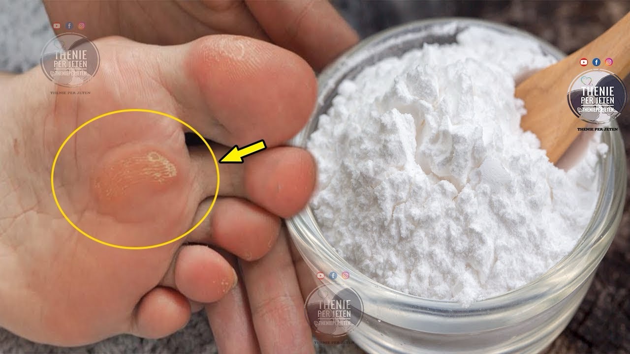 🦶 Receta e gjyshes – Ja sekreti si t’i hiqni kallot dhe mykun nga këmbët brenda një nate të vetme!