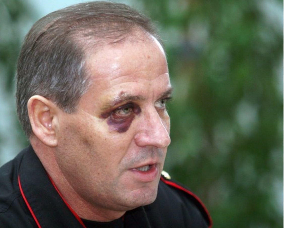 “Misteri i syrit të nxirë të Ndrea Prendit rikthehet: Ja çfarë tha Berisha!”